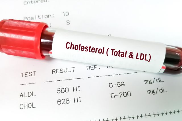How to Lower Cholesterol Naturally After 50 (Without Medication If Possible)