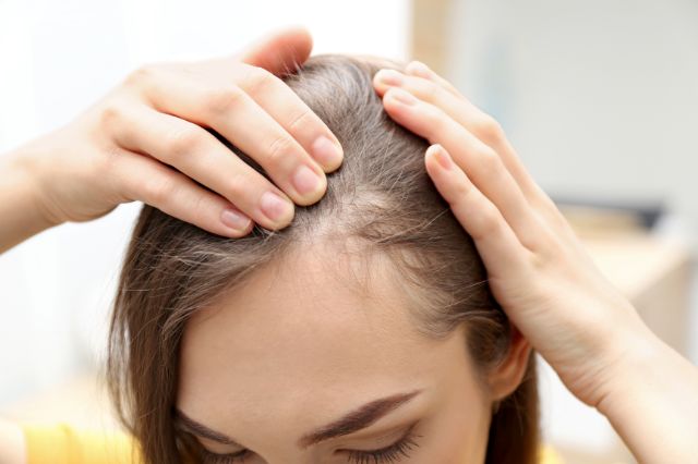 Can You Regrow Lost Hair After 50? What Actually Works According to Science